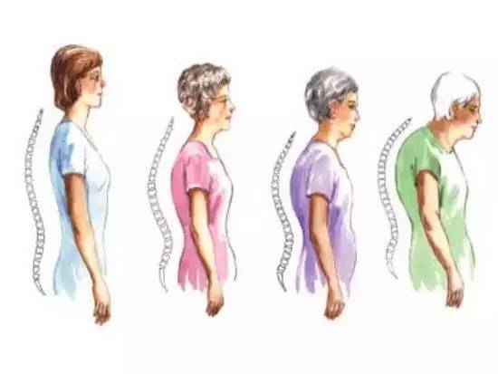 杨幂,要正视你的驼背问题了