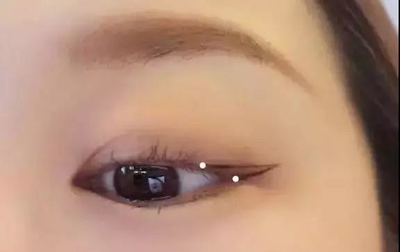 眼睛距离近适合什么镜框，眼睛距离宽是什么原因
