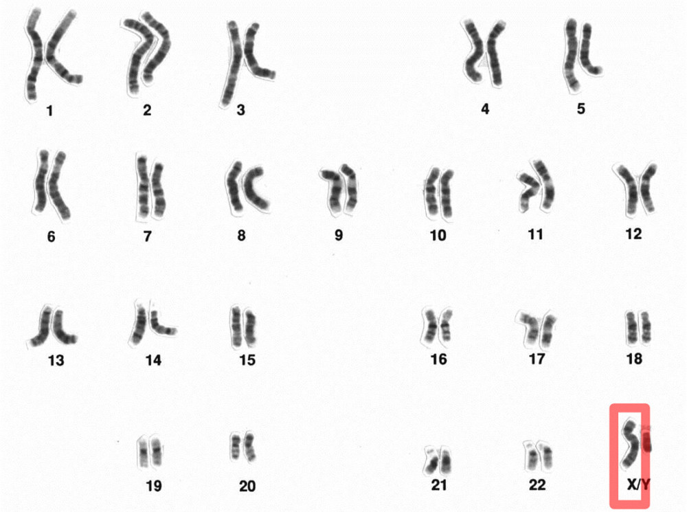 染色体,y染色体,x染色体,yy染色体,基因