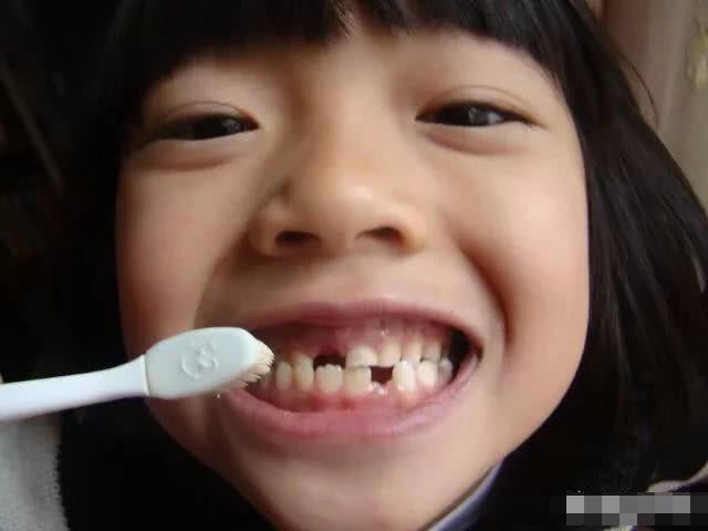 七岁小孩换牙长歪了,怎么样才能让牙长正?此办法多数人都不知道