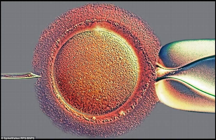 英国皇家摄影协会精美显微摄影作品_腾讯网触