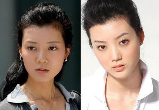 车晓被曝整容过度鼻子外翻太明显像迈克杰克逊图