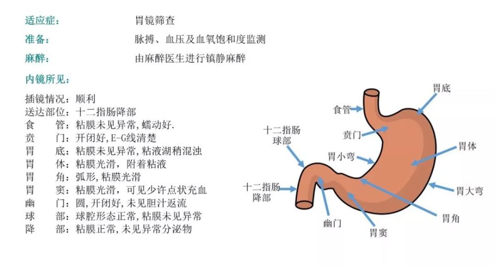 溃疡,浸润……胃镜报告里出现这些意味着什么?