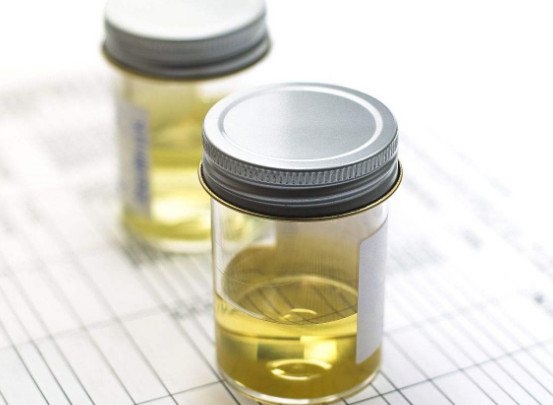 男性去厕所时,一旦出现2种迹象,八成是前列腺