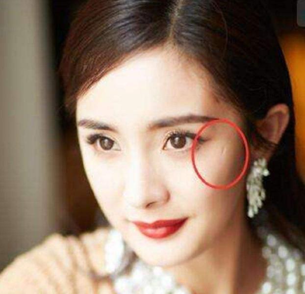 这些当红明星脸上的疤痕是怎么留下来的?鹿晗的最无语杨幂最搞笑