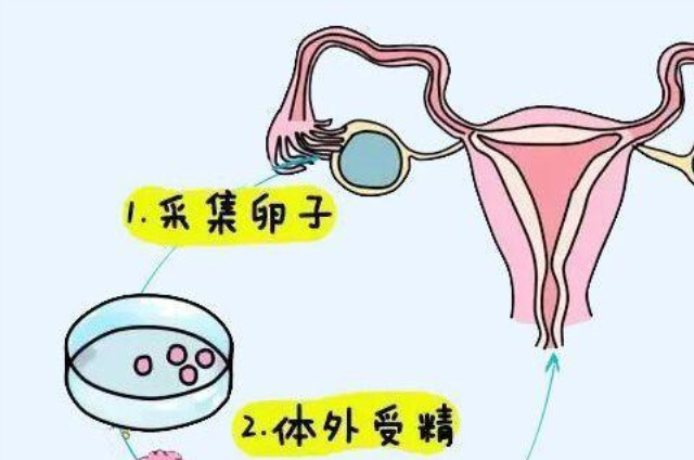 不妊治療で自己注射 めまい 気持ち悪い 暑い 副作用オンパレード 妊活日記19 Oggi Jp
