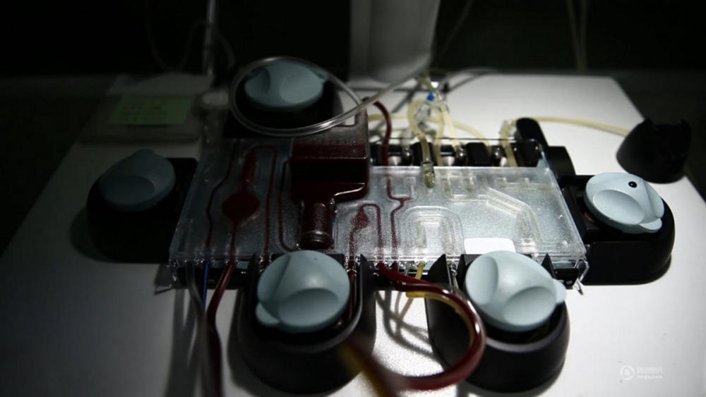 白血病儿家庭因病致贫:父亲欲卖肾救女