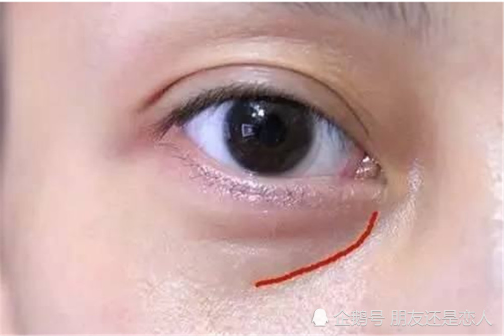 眼袋下垂松弛很显老,只需三个自制方法,细纹眼