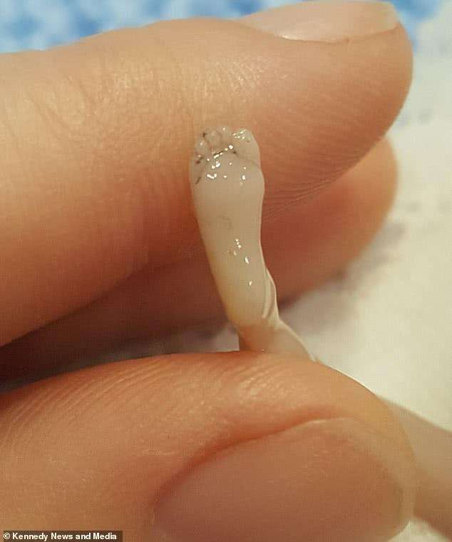妇女流产后把10厘米大婴儿尸体放冰箱,并发文呼吁永远