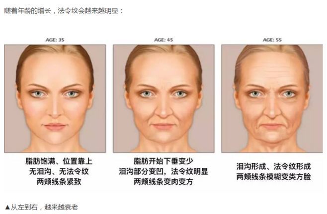 比皱纹更显老的法令纹,你该拿它怎么办?
