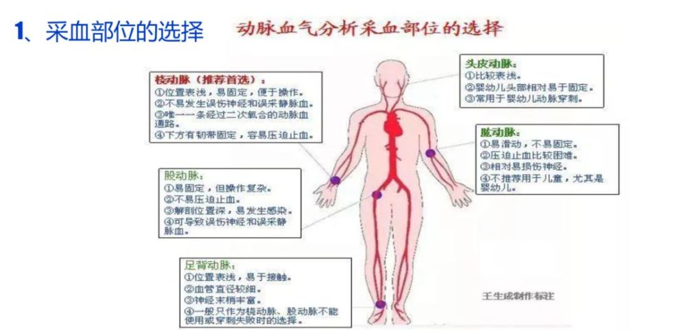 采血,动脉