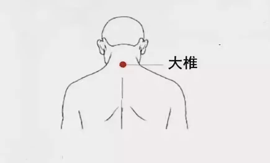 (1)大椎(可加风门,肺俞)