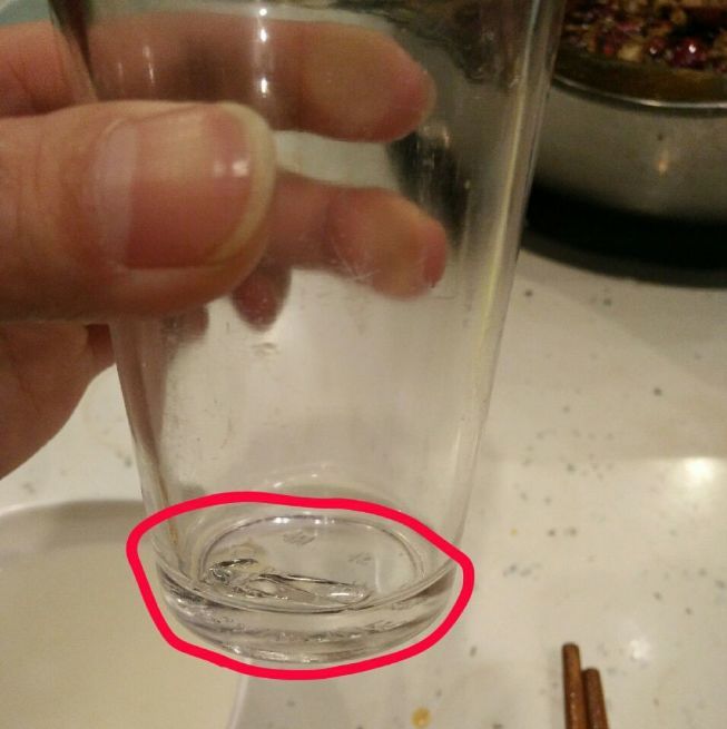 网曝:自贡男子吃饭时疑似误吞玻璃渣,商家竟说