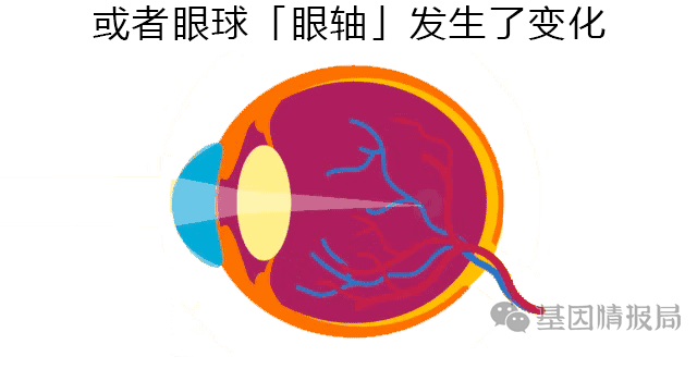 不戴眼镜不开刀,就能永久治好近视,这将是真的
