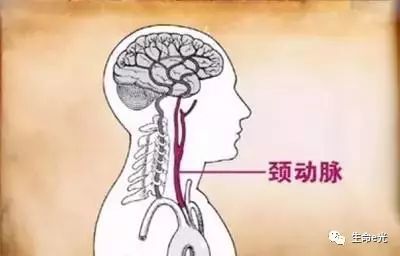 它是血液从心脏流向头脑部的主干河流,这就是颈动脉