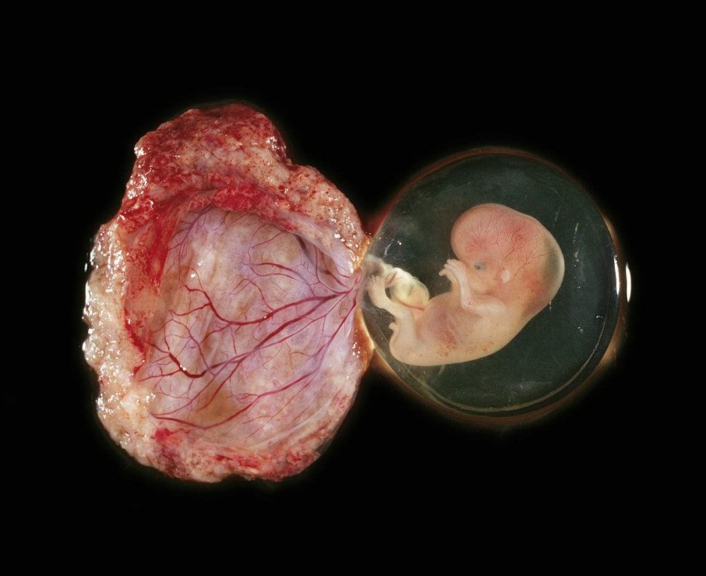 发育生物学重大创新:人类胎盘"类器官"可长期稳定培养
