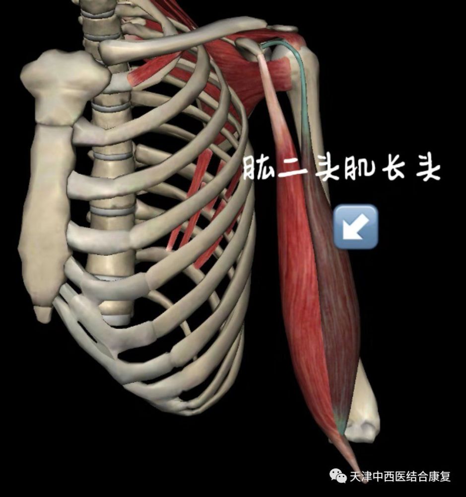 肱二头肌肌腱炎的康复治疗