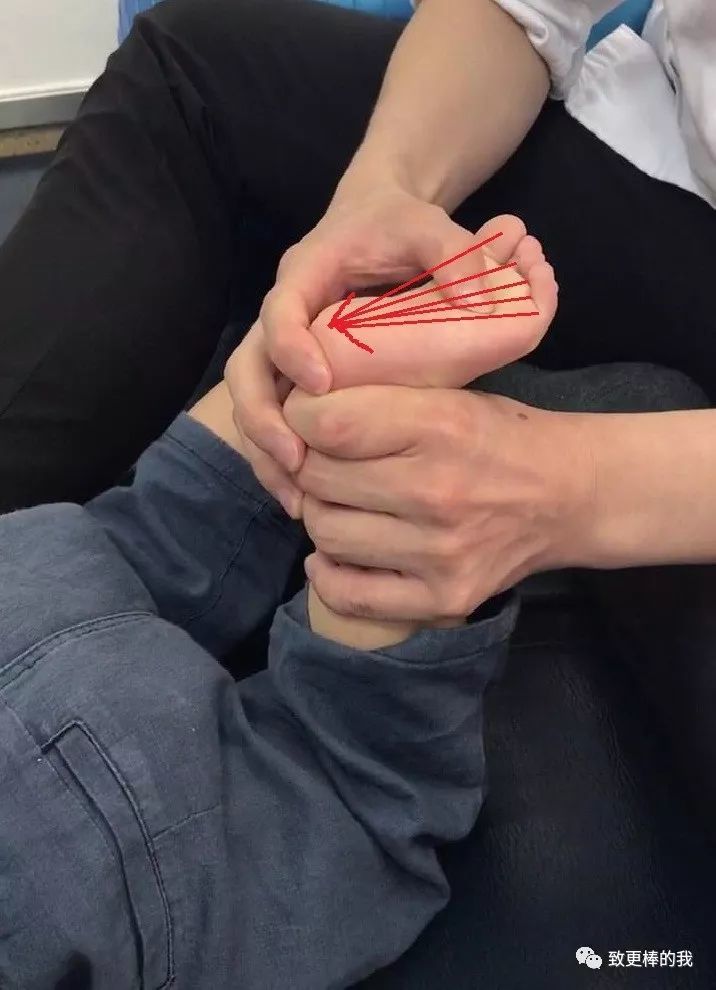先天性内翻足宝宝康复——家庭辅助按摩篇