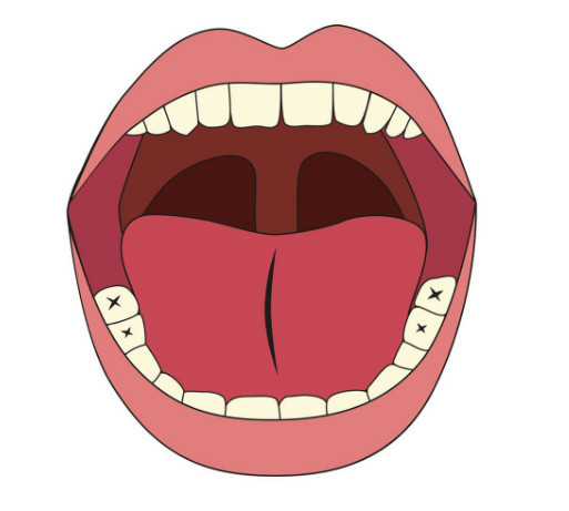 2900万艾滋病者死亡,不论男女,舌头有这标志