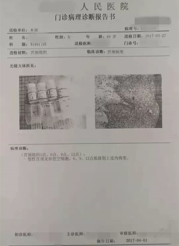 病例分享-接触性出血等非正常出血要警惕