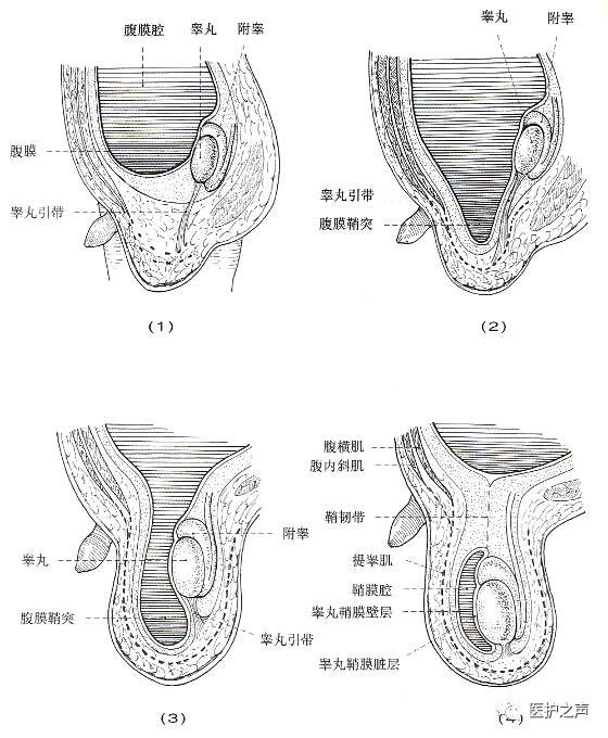 精索外筋膜external spermatic fascia:为腹外斜肌腱膜的延续;提睾肌