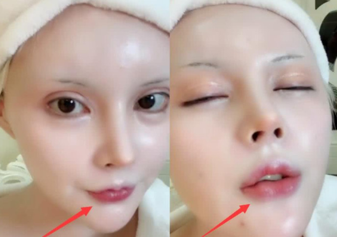 迪丽拉开播自爆,"嘟嘟嘴"的形成原因,网友:确实没整容