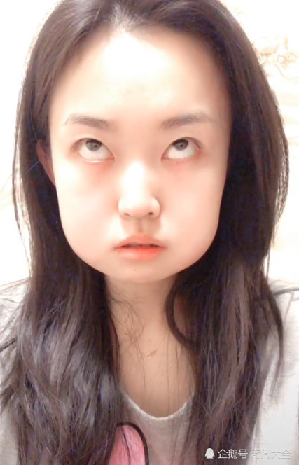智齿,蟠桃,口腔,牙疼,牙齿