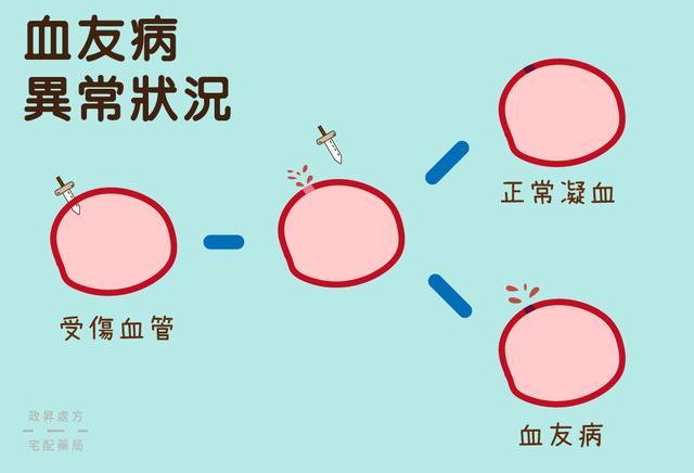血友病是什么病 腾讯网
