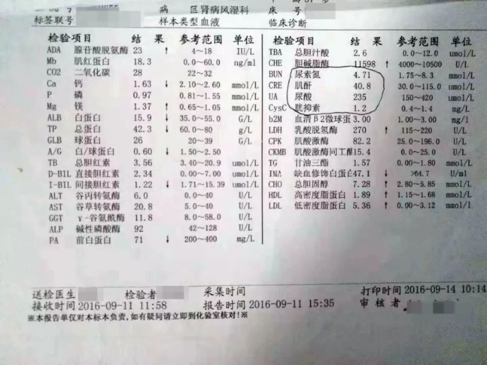 可惜了,这么年轻得肾病?尿蛋白3 ,血白蛋白低到15,如今我康复得很好