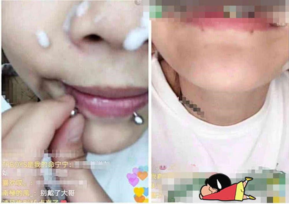 女生把唇钉去掉是什么样子?很多人都不敢想,网友:喝什么漏什么