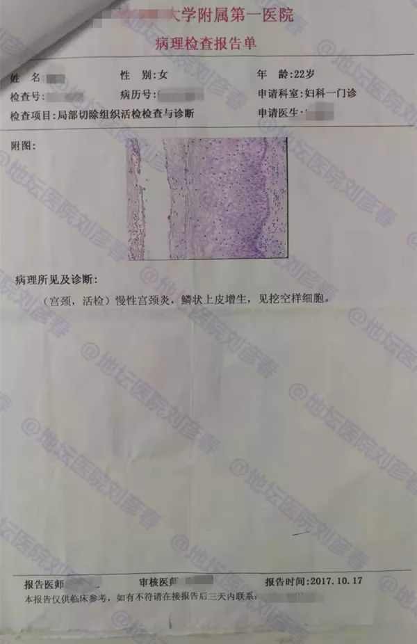 病例分享-免疫力与hpv病毒与宫颈癌的关系 鲍文氏丘疹
