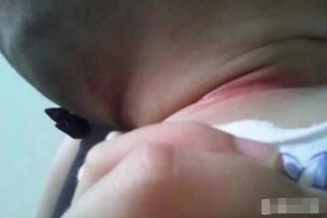 宝宝大腿内侧淹了该怎么办?看完后瞬间明白了!