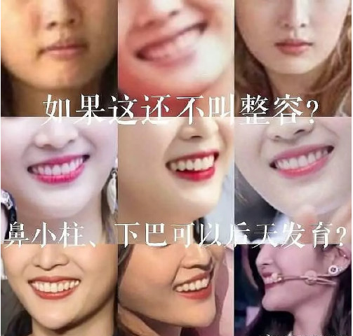 皇冠开户网