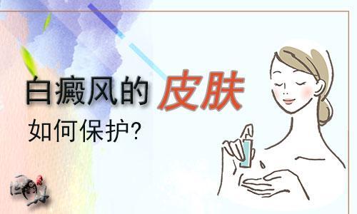 白癜风疾病对于防晒的重要性 看点快报