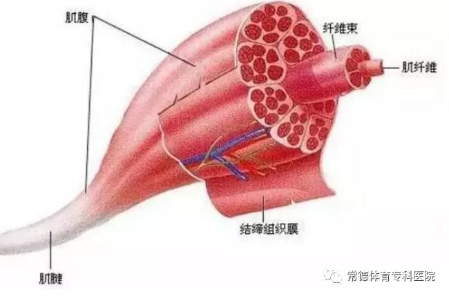 中度:肌肉部分撕裂,较多的肌纤维撕裂,肌肉力量明显下降,并伴有