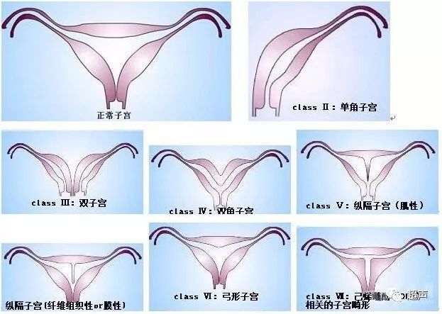 生殖器未发育或发育不全