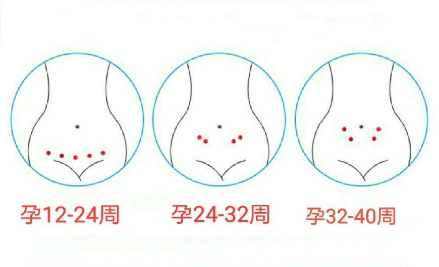 孕产说:小宝宝的胎心一般在哪个位置?