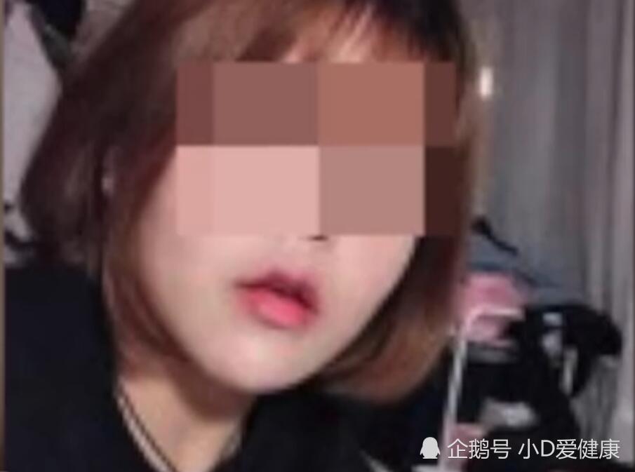 贵州19岁女大学生隆鼻死亡 真相解析 看点快报