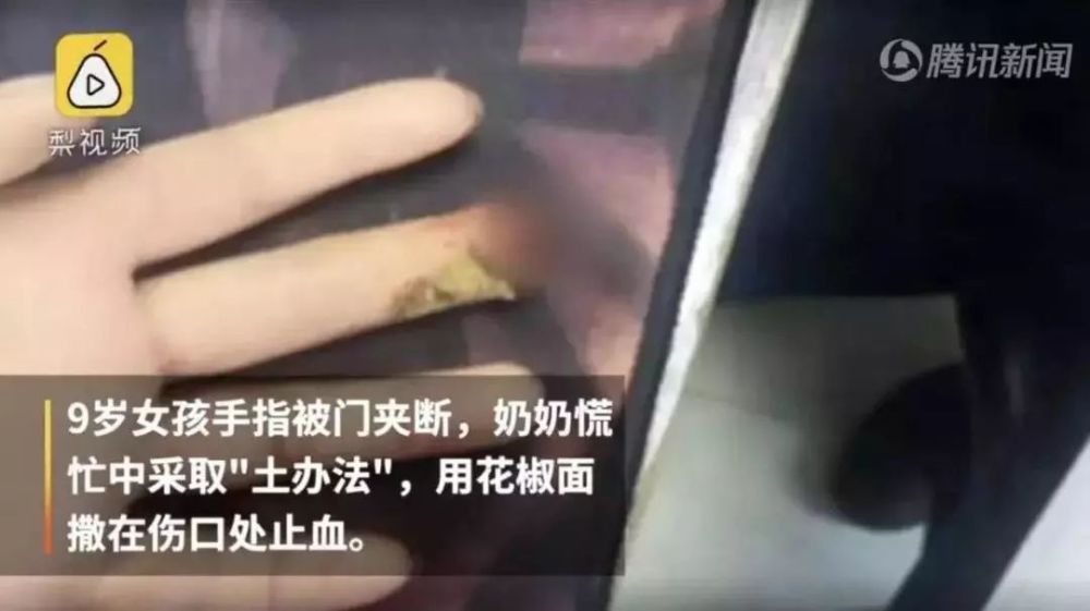 女孩手指被门夹要截肢?只因奶奶用这个方法给她止血