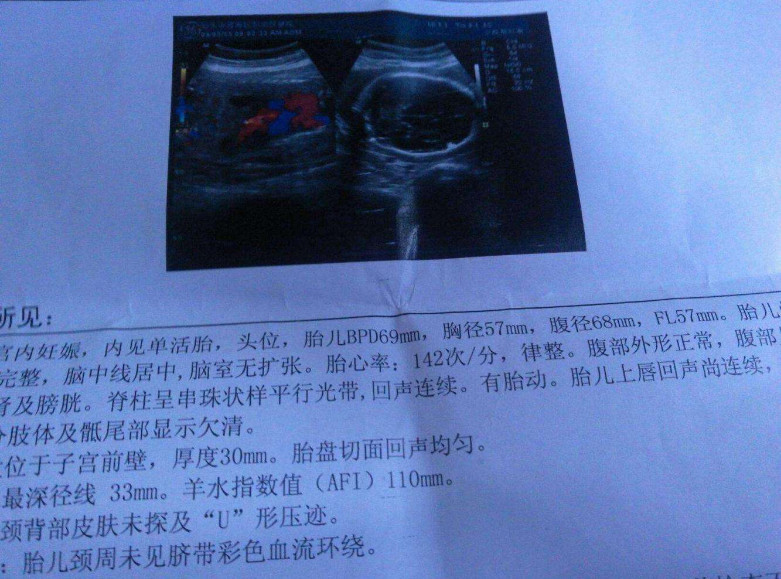心率的数据,如果数值在120次/min到140次/min的话,那胎儿是男孩的几率