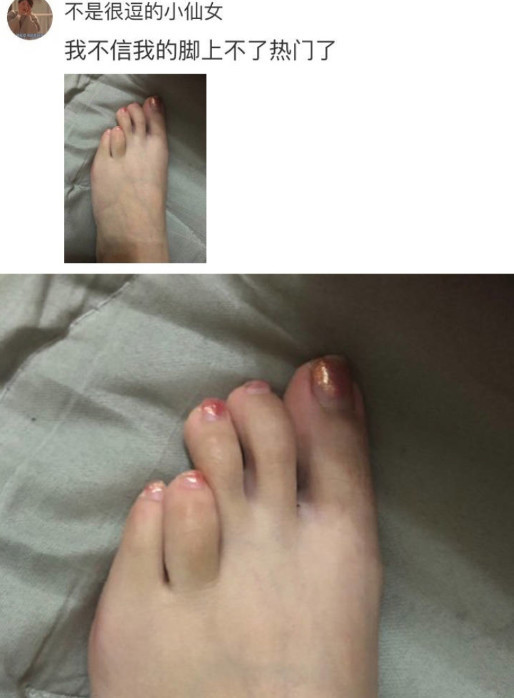 所以脚就可能有点歪,毕竟尖尖的高跟鞋有时会挤压脚型