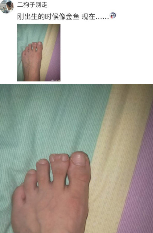 所以脚就可能有点歪,毕竟尖尖的高跟鞋有时会挤压脚型