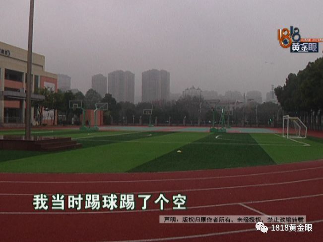 踢足球把小腿踢断吗，踢足球把小腿踢断吗图片