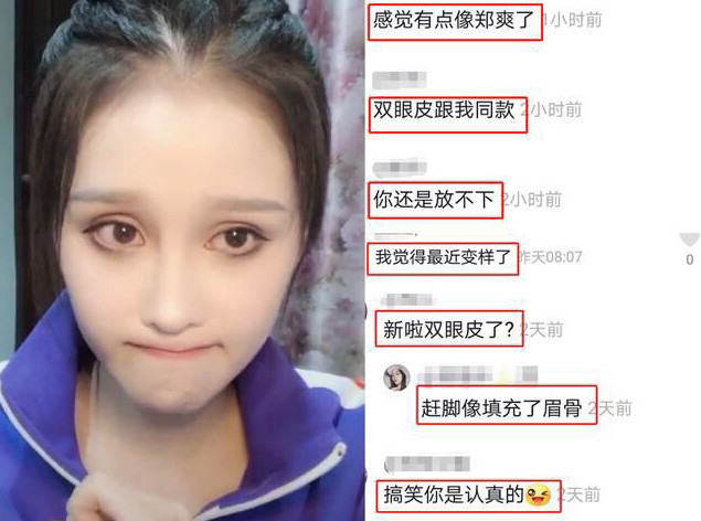 赵本山女儿球球撞脸郑爽!超大眼睛太吓人,网友直呼像外星人!