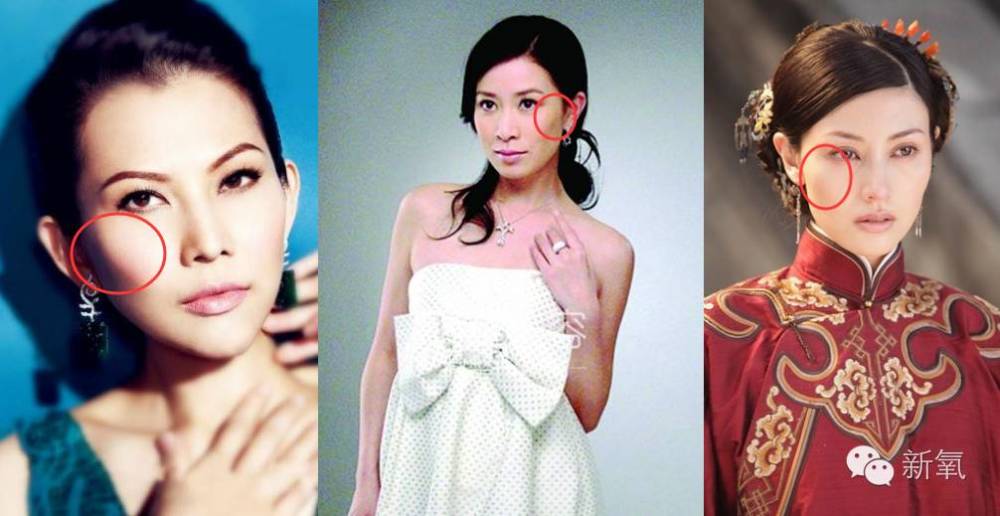 痛苦,笑起来丑10倍的女星不止杨幂刘亦菲.