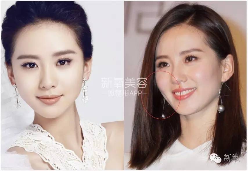 痛苦,笑起来丑10倍的女星不止杨幂刘亦菲.