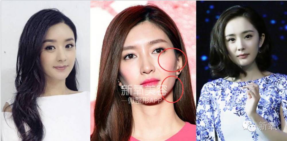 痛苦,笑起来丑10倍的女星不止杨幂刘亦菲.