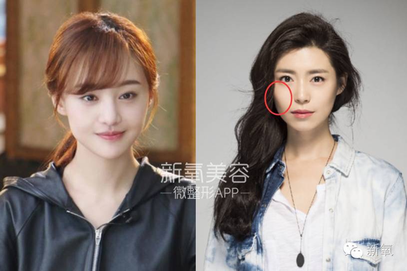 痛苦,笑起来丑10倍的女星不止杨幂刘亦菲.