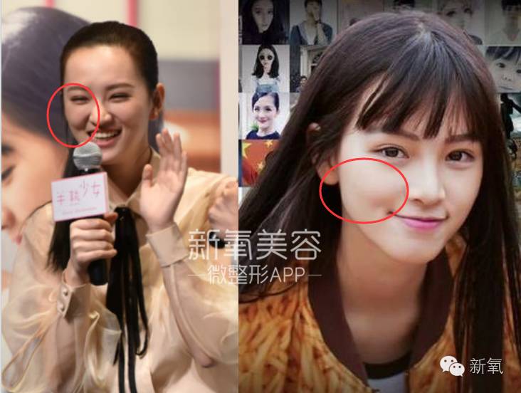 痛苦,笑起来丑10倍的女星不止杨幂刘亦菲.