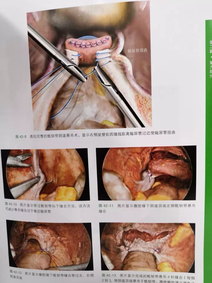 《盆腔解剖与妇产科手术图谱》上中下卷